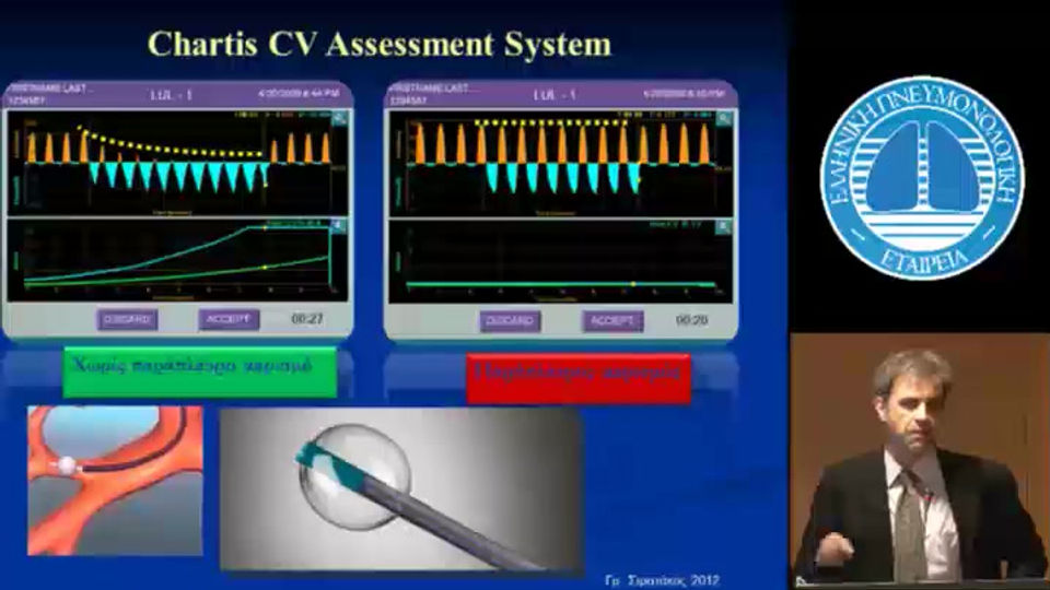 Μείωση όγκου στο πνευμονικό εμφύσημα (BLVR)